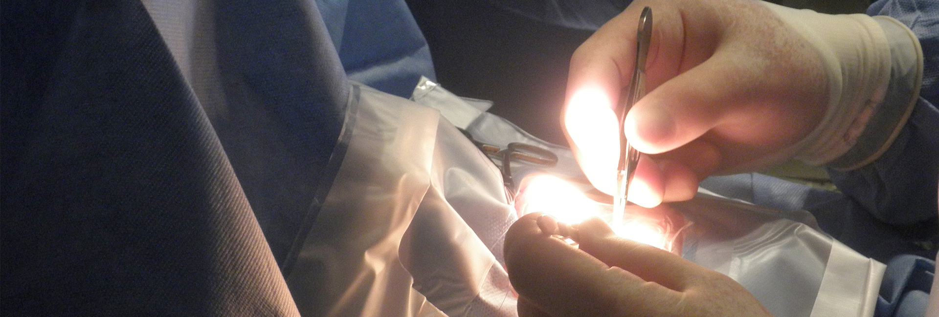 Surgery